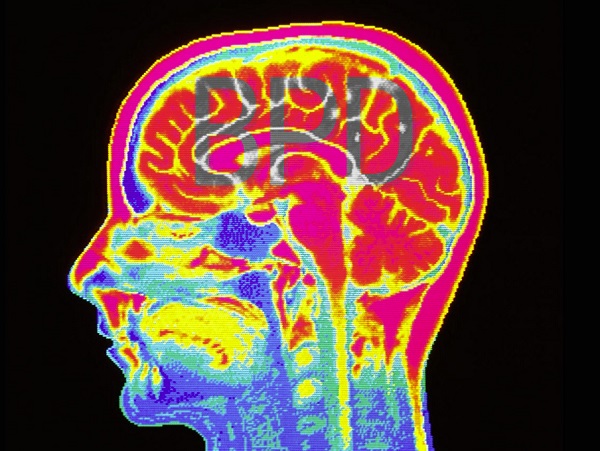 You Can Now Get Diagnosed with BPD Via a Simple Brain Scan!